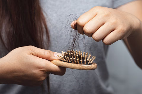 ¿Sabes identificar tu tipo de caída de cabello?