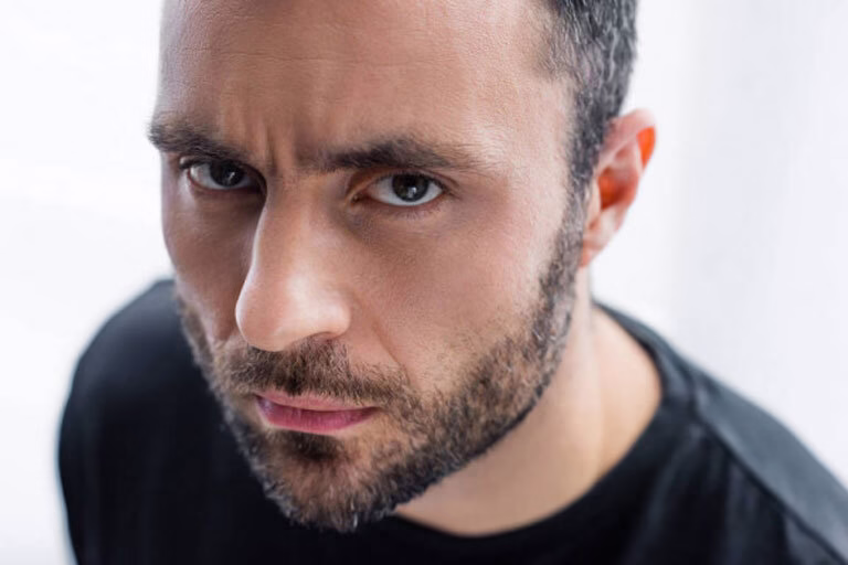 Círculo sin pelo en la cabeza. ¿Es alopecia?