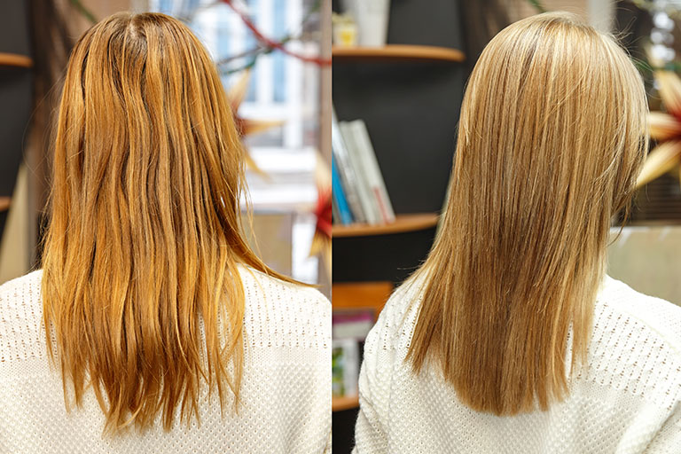 ¿La keratina produce alopecia?