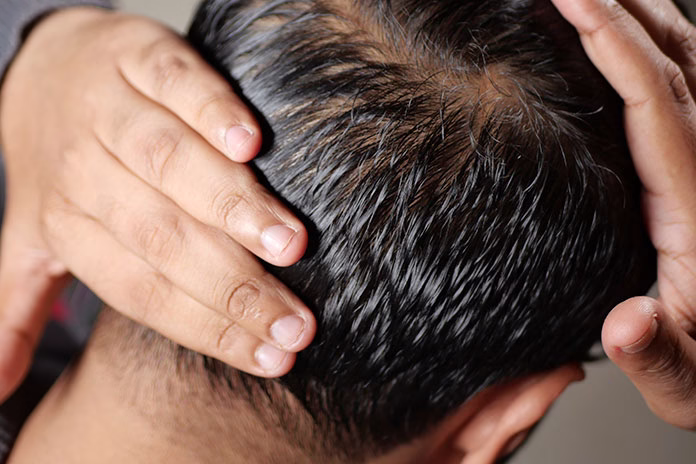 Consejos para el cuidado del pelo graso
