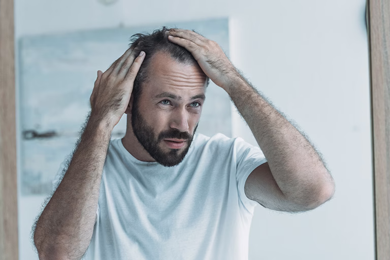 ¿Cómo combatir la alopecia por estrés?