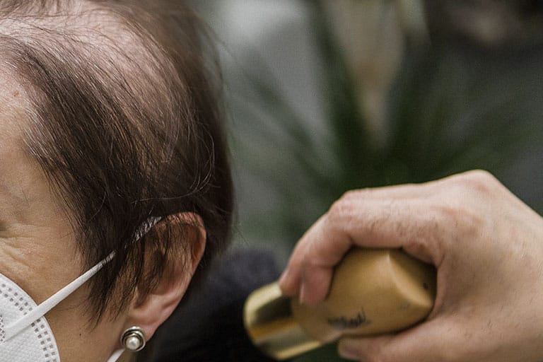 Caida de pelo mujer soluciones