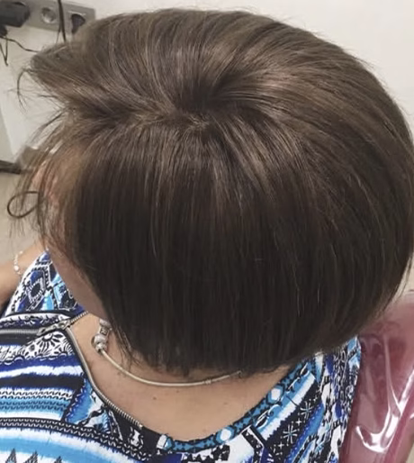 Melena con volumen y densidad recuperados con peluca para mujer