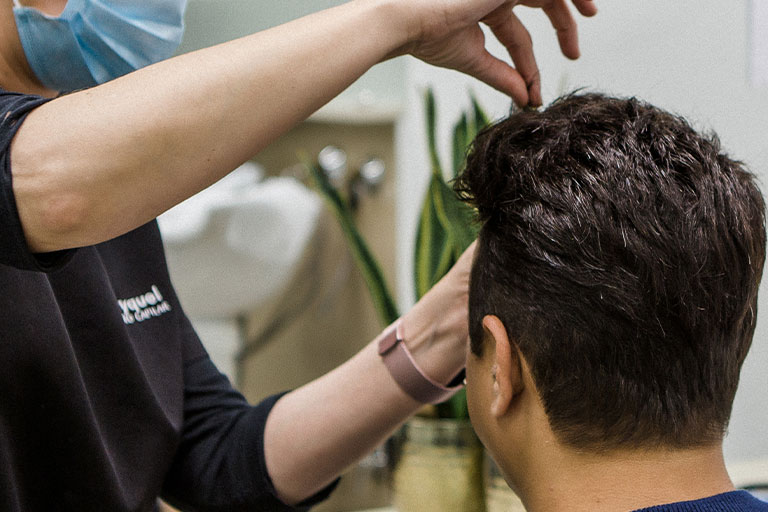 Mejores productos para disimular la calvicie en hombres